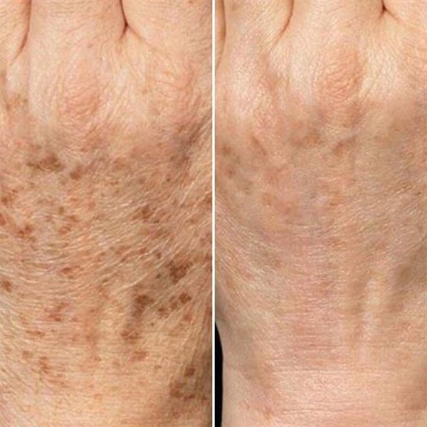 Estética corporal